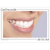 Spanish Smile Appointment Confirmation Recall Cards
